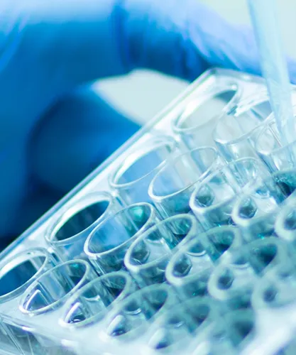 Hand mit blauem Handschuh arbeitet im Labor mit einer Pipette und einer Zellkulturplatte.