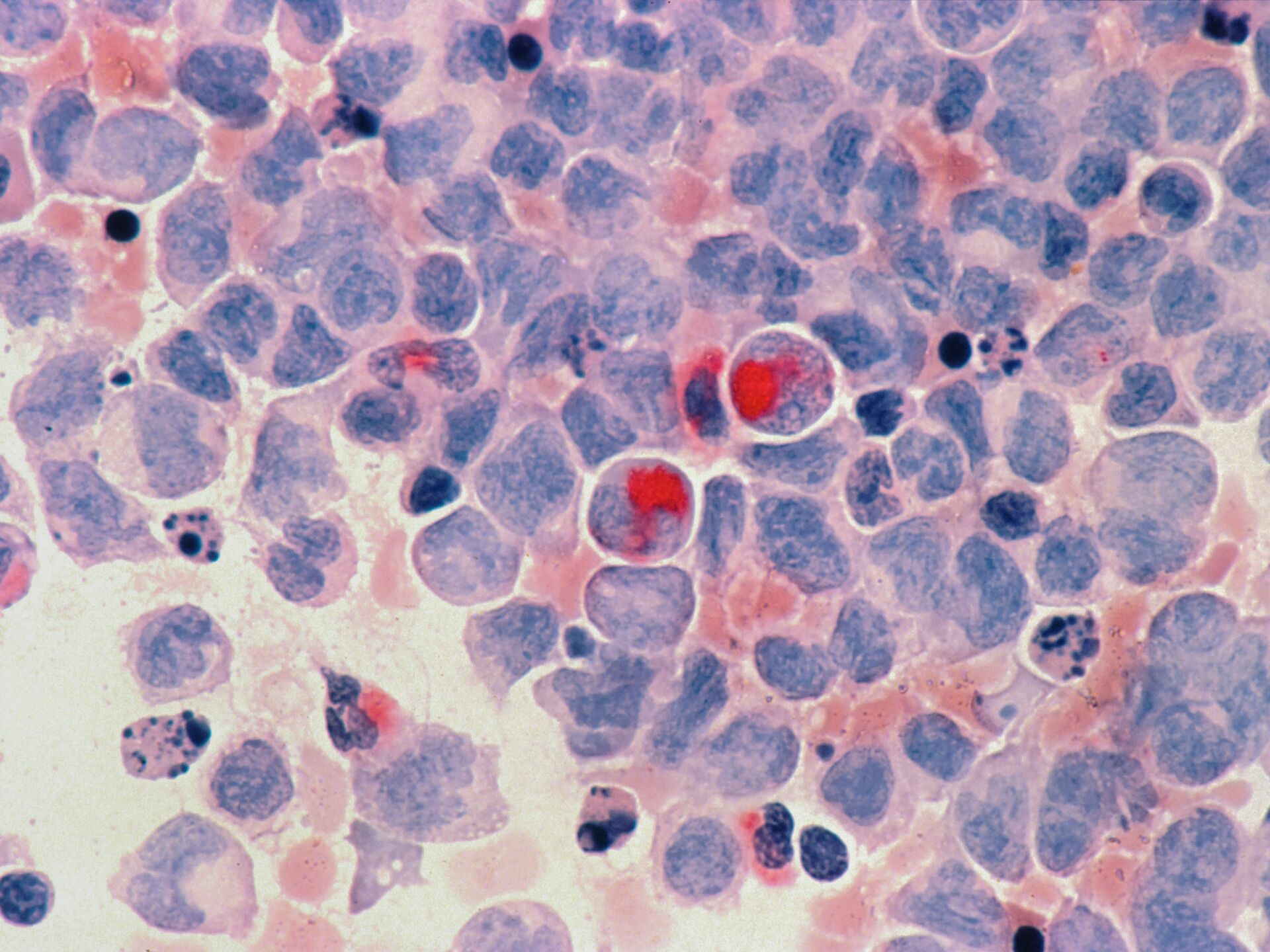 Mikroskopische Aufnahme von gefärbten Zellen in Blau- und Rottönen, vermutlich Gewebe- oder Blutzellen.
